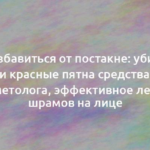 Как избавиться от постакне: убираем рубцы и красные пятна средствами или у косметолога, эффективное лечение шрамов на лице 