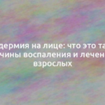 Пиодермия на лице: что это такое, причины воспаления и лечение у взрослых 