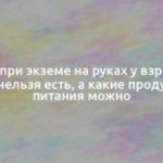 Диета при экземе на руках у взрослых: что нельзя есть, а какие продукты питания можно 