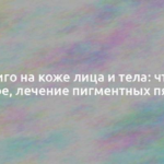 Лентиго на коже лица и тела: что это такое, лечение пигментных пятен 