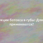 Инъекции ботокса в губы: Для чего применяются? 