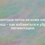 Пигментные пятна на коже лица от солнца – как избавиться и убрать пигментацию 