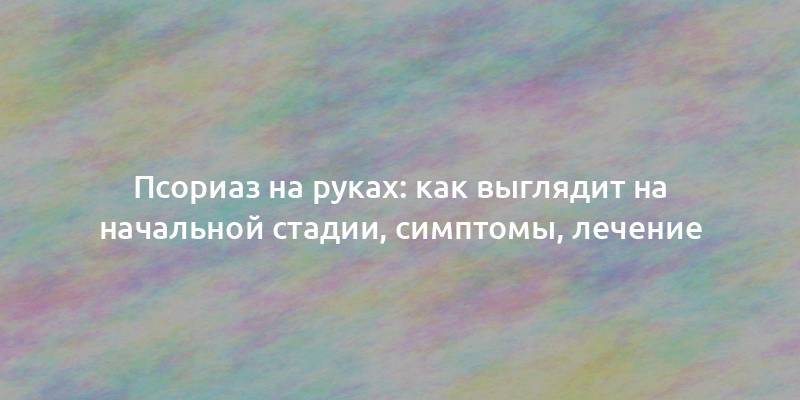 Псориаз на руках: как выглядит на начальной стадии, симптомы, лечение