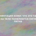 Пигментация кожи: что это такое, почему на теле появляются пигментные пятна 