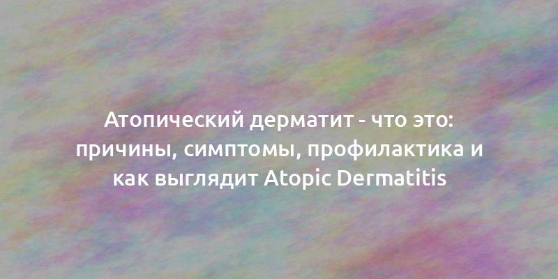 Атопический дерматит - что это: причины, симптомы, профилактика и как выглядит Atopic Dermatitis