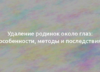 Удаление родинок около глаз: особенности, методы и последствия 