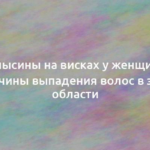 Залысины на висках у женщин – причины выпадения волос в этой области 