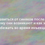 Как избавиться от синяков после уколов, почему они возникают и как этого избежать во время инъекций 