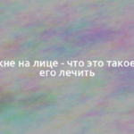 Постакне на лице — что это такое и чем его лечить 