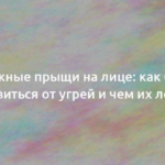 Подкожные прыщи на лице: как быстро избавиться от угрей и чем их лечить 